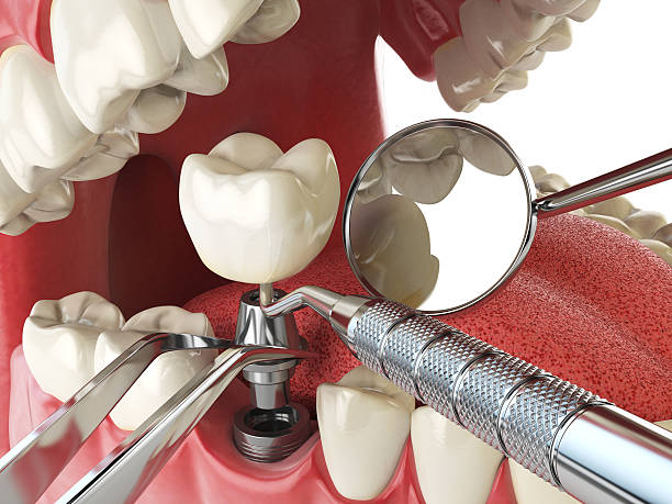 Best Emergency Denture Repair in Falls Creek, PA
